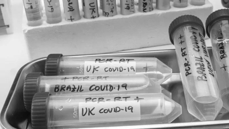 HIV – What is the Bristol Variant of Coronavirus? image 0